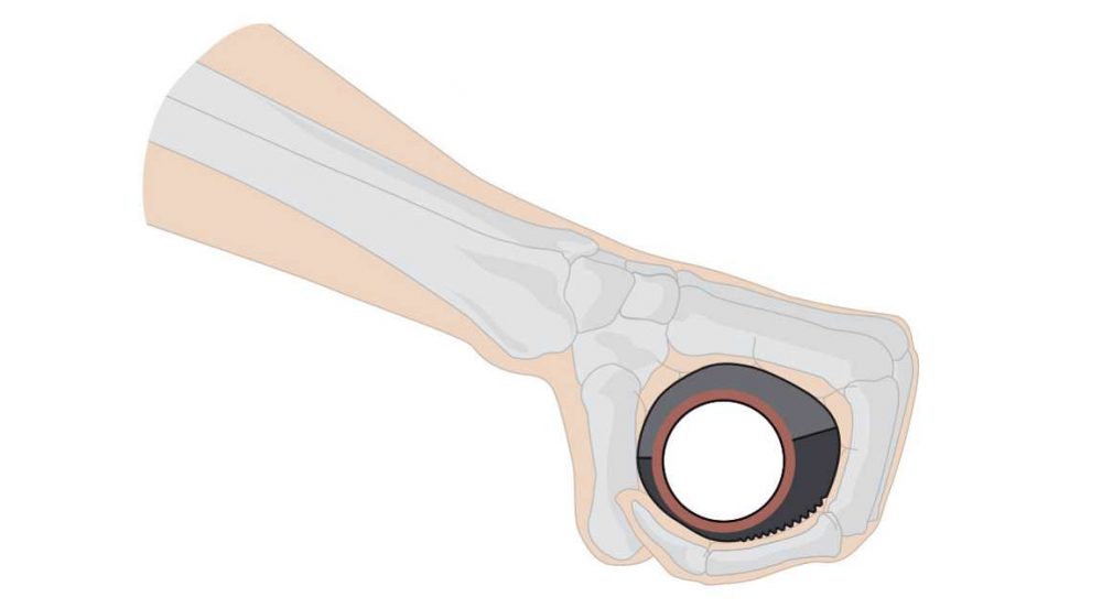 Schmerzen durch ergonomische Komponenten vermeiden